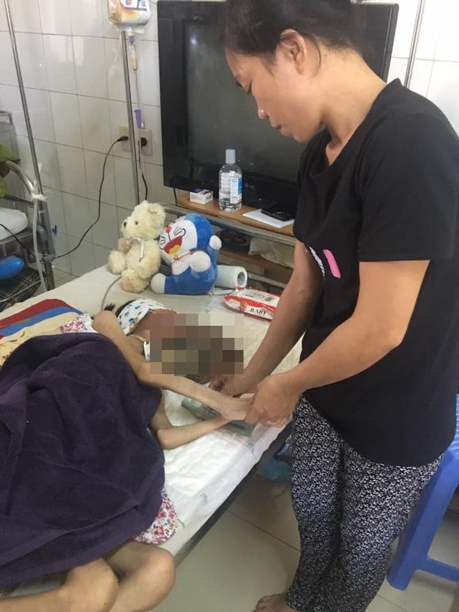  Chuỗi ngày đau đớn của bé gái 11 tuổi, mồ côi cha, bị khối u quái ác che kín mặt - Ảnh 2.