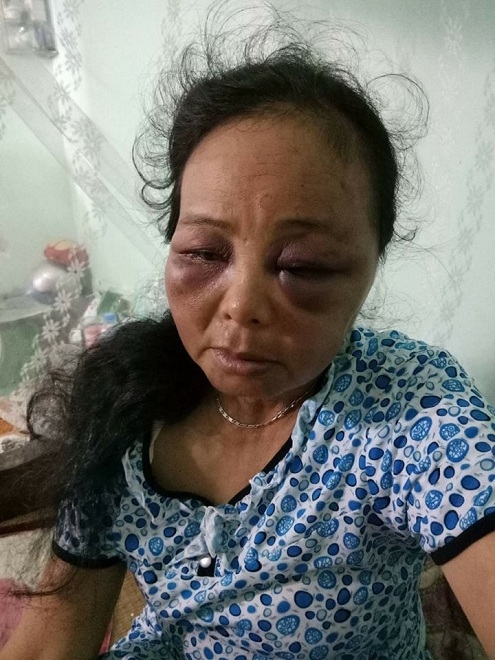 tran tinh cua 2 nguoi phu nu bi danh bam dap vi nghi bat coc tre con hinh anh 2