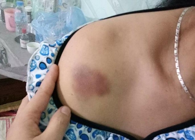 tran tinh cua 2 nguoi phu nu bi danh bam dap vi nghi bat coc tre con hinh anh 3