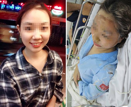 Mẹ của nữ sinh bị tạt axit cho biết chưa nhận được 300 triệu của Trương Ngọc Ánh hứa cho con gái - Ảnh 6.
