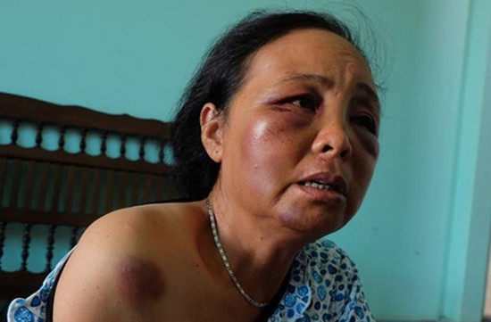 2 phu nu ban tam quyet lam ro dung sai sau vu bi danh nhap vien hinh anh 2