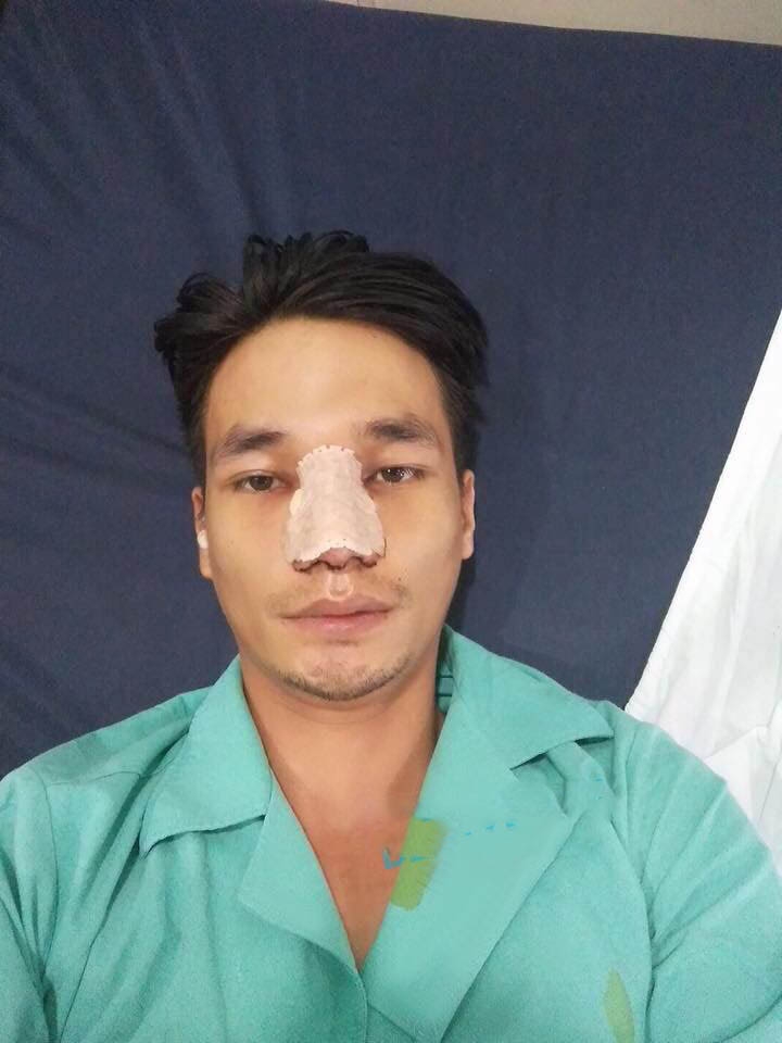 het tung son lai toi le roi bat ngo lo anh phau thuat tham my hinh anh 2