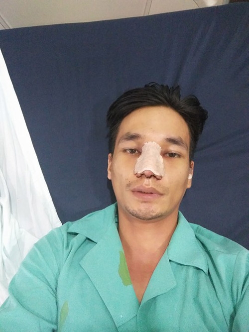 le roi lo hinh anh ngo ngang sau ca dai phau nhan sac hinh anh 2