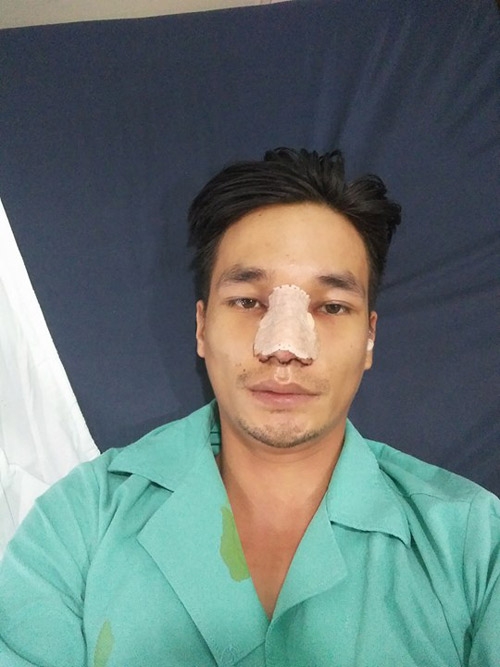 le roi lo hinh anh ngo ngang sau ca dai phau nhan sac hinh anh 3