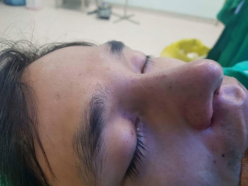 le roi lo hinh anh ngo ngang sau ca dai phau nhan sac hinh anh 4