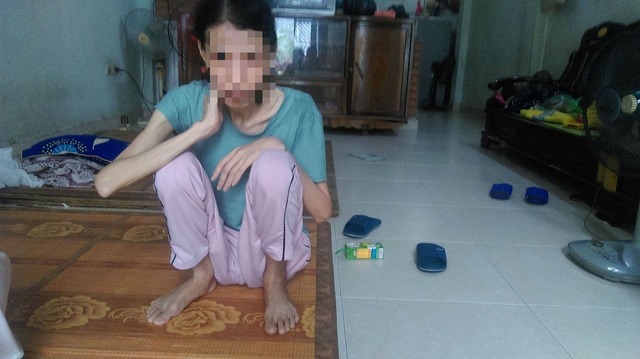  Trước đây chị Nguyễn Thị Điệp nặng 50kg, hiện tại chị nặng 33kg. Ảnh: Ngọc Thi 