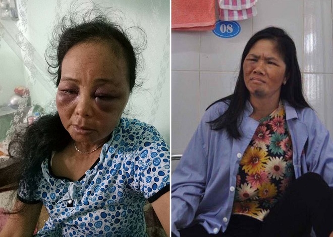 vu 2 phu nu ban tam bi danh: ba noi chau be nghi bi bat coc len tieng hinh anh 2