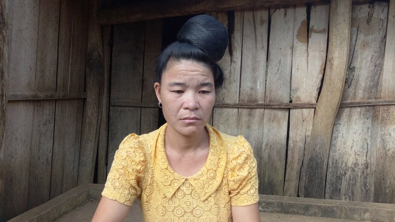 bệnh lạ, Sơn La bệnh lạ, Sơn La