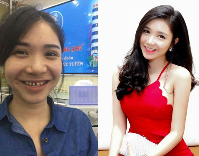 Thanh Bi: 'Hinh anh tren mang xa hoi da bi sua xau di' hinh anh 1