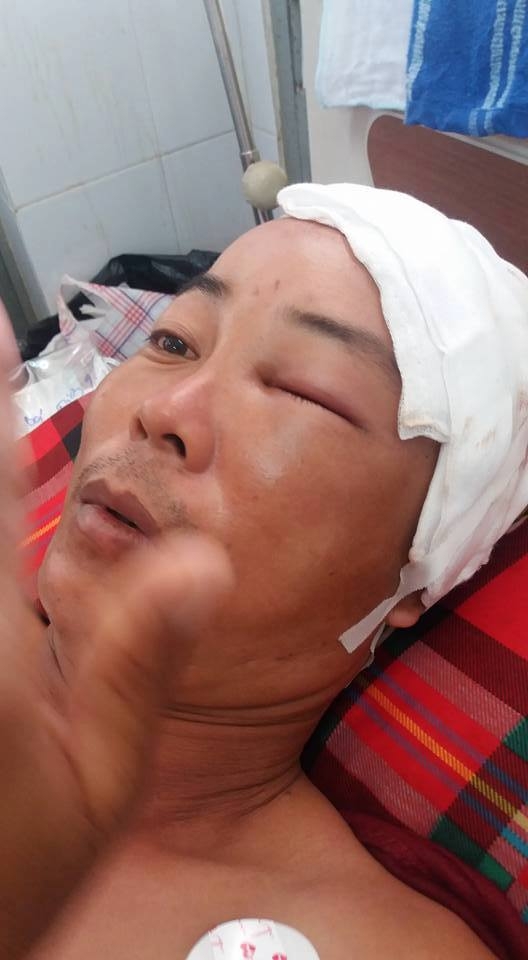 dak lak: hai cong an xa xo xat, mot nguoi bi chan thuong so nao hinh anh 1