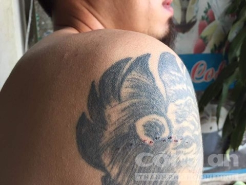 Nạn nhân vụ truy sát: Các anh của em đều gần chết hết rồi, xin anh tha mạng... - Ảnh 1.