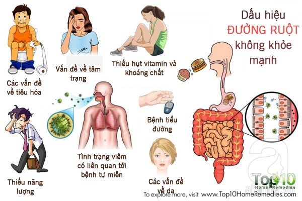 10 dấu hiệu tố cáo đường ruột của bạn đang gặp trục trắc - Ảnh 1.