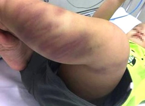 Ba ngoai be trai 1 tuoi bi bao hanh: Sao ho doc ac the? hinh anh 2