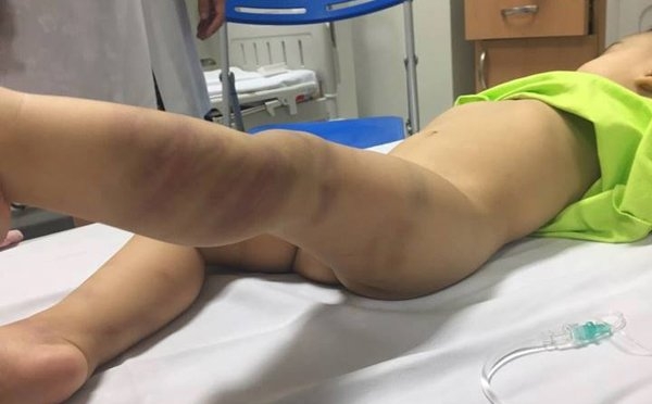 bạo hành trẻ em, ngược đãi trẻ em, Hà Nội