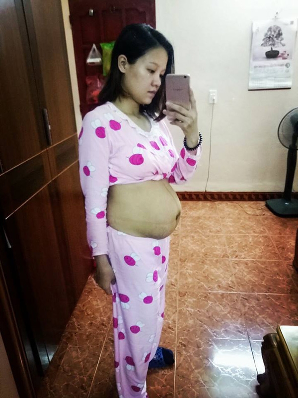 vong eo 10 ngay sau sinh “nhu chua de