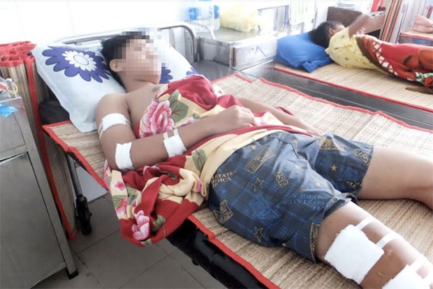  Đang đứng trước nhà, một học sinh lớp 10 bị chém nhập viện - Ảnh 1.