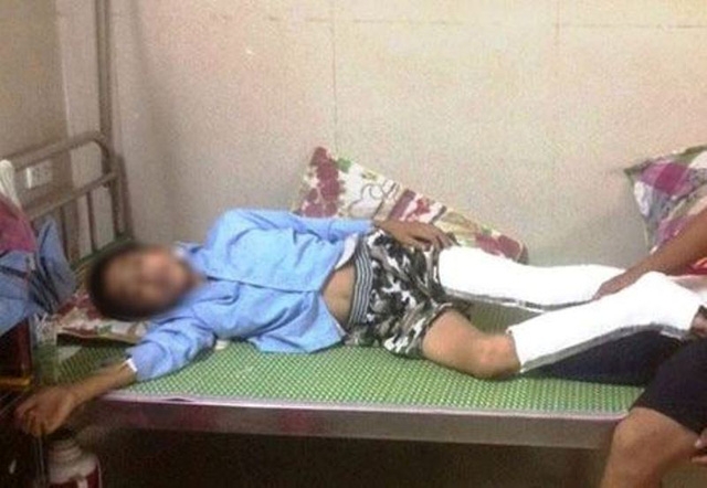 Em Q. bị gãy chân sau khi nhảy từ tầng 3 xuống đất, sau một tuần vẫn chưa khỏi để đi học trở lại được.