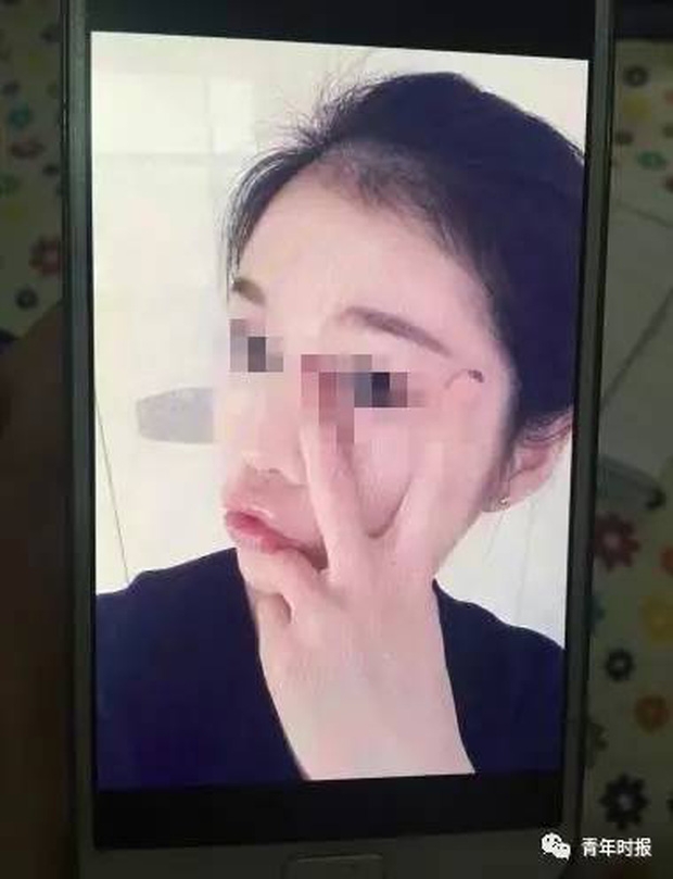 Yêu đơn phương 8 năm không được đáp trả, người đàn ông ném cô gái qua ban công tầng 19 - Ảnh 3.