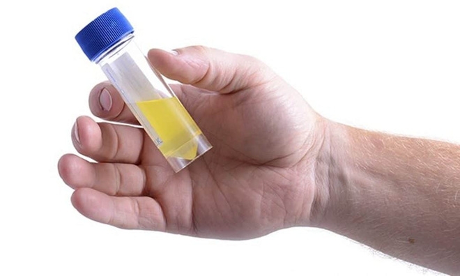 Nước tiểu có bọt: Dấu hiệu báo động không thể bỏ qua - Ảnh 4.