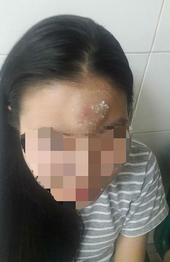 nữ công nhân, côn đồ, Đà Nẵng
