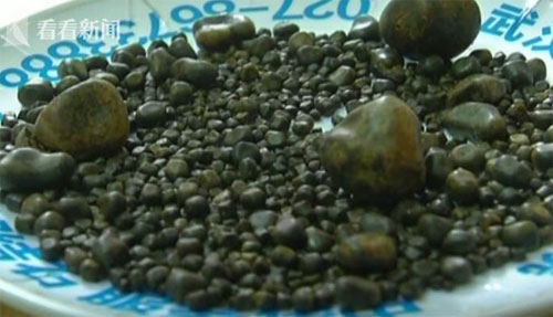 cu-ba-co-806-vien-soi-trong-tui-mat