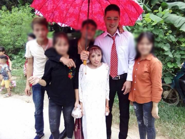dam cuoi cua chu re lang son va co dau thap coi suy dinh duong 