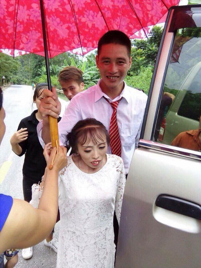 dam cuoi cua chu re lang son va co dau thap coi suy dinh duong 