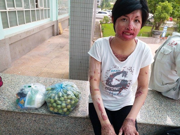 Gặp lại người phụ nữ từng bị chồng nhốt, tẩm xăng thiêu sống: Tôi không còn oán hận, chỉ mong có ngày đoàn tụ với con - Ảnh 4.