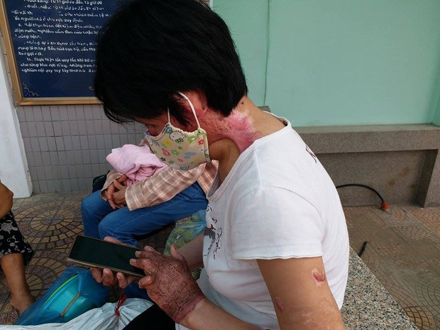 Gặp lại người phụ nữ từng bị chồng nhốt, tẩm xăng thiêu sống: Tôi không còn oán hận, chỉ mong có ngày đoàn tụ với con - Ảnh 5.