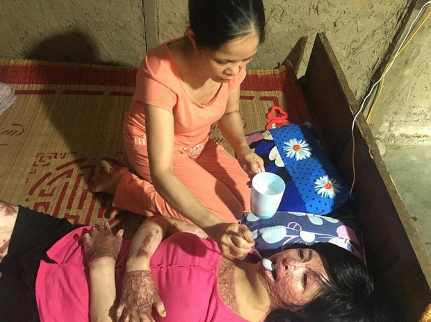 Gặp lại người phụ nữ từng bị chồng nhốt, tẩm xăng thiêu sống: Tôi không còn oán hận, chỉ mong có ngày đoàn tụ với con - Ảnh 6.