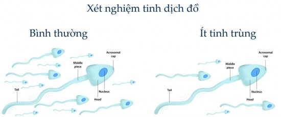 Mãn dục nam - hiểu để ứng phó phù hợp