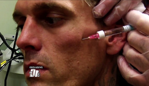 aaron-carter-lo-bi-nhiem-hiv-1