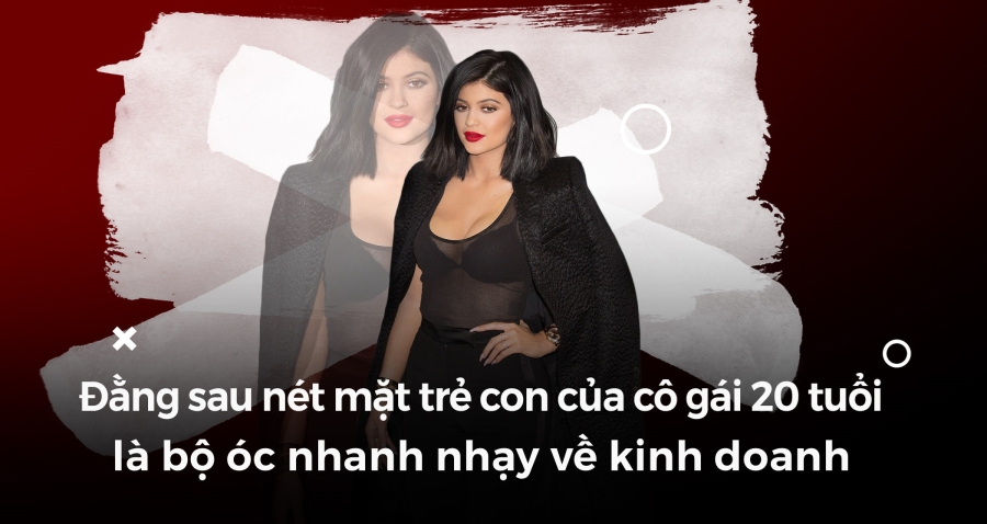 Kylie Jenner - tu co em ut 'xau xi' nha Kardashian den hot girl ty do hinh anh 5