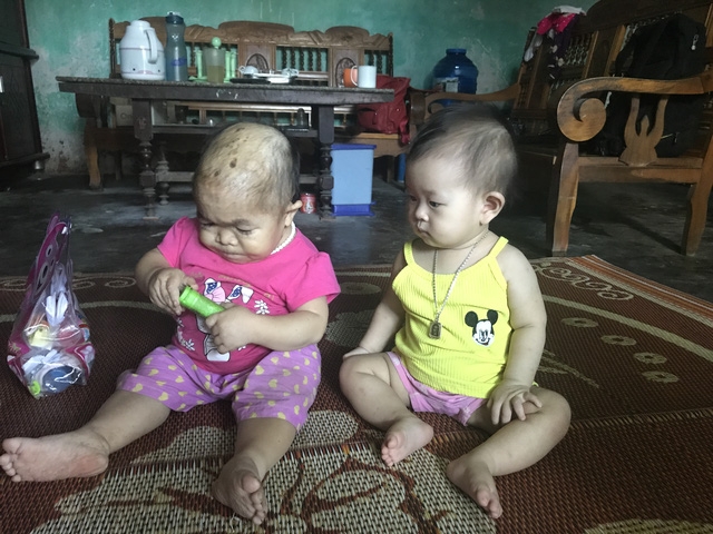 Dù đã 27 tuổi những chị Dung chỉ trông như một đứa trẻ lên 2. Trong ảnh là Dung với người cháu ruột năm nay 9 tháng tuổi. Ảnh: Minh Anh
