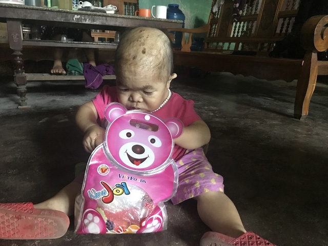 Theo bà Nguyễn, Dung cũng thích nũng nịu đòi đồ chơi mới, vui vẻ khi được mua quần áo đẹp. Ảnh: Minh Anh
