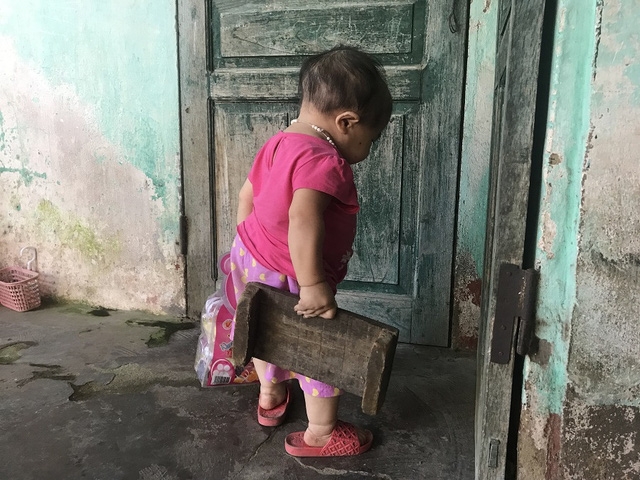 Dung hiếm khi ra khỏi nhà, hàng ngày cô chỉ quanh quẩn làm bạn với những món đồ chơi của mình. Ảnh: Minh Anh.