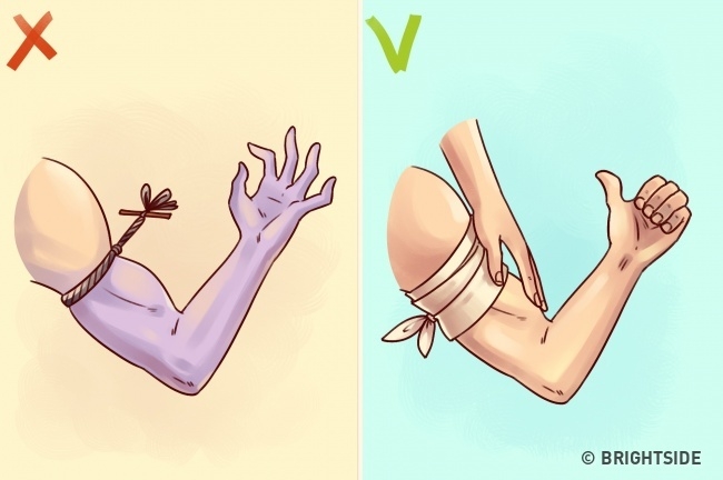 7 sai lầm trong sơ cứu vết thương, bị bệnh khiến bạn nguy hiểm - Ảnh 6.