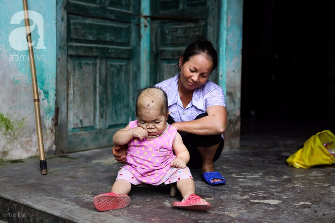 Cuộc đời cô gái gần 30 vẫn mang hình hài của đứa trẻ 2 tuổi: Lủi thủi trong nhà cả đời, không có bạn cùng - Ảnh 2.