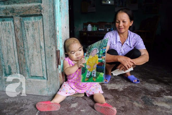 Cuộc đời cô gái gần 30 vẫn mang hình hài của đứa trẻ 2 tuổi: Lủi thủi trong nhà cả đời, không có bạn cùng - Ảnh 17.