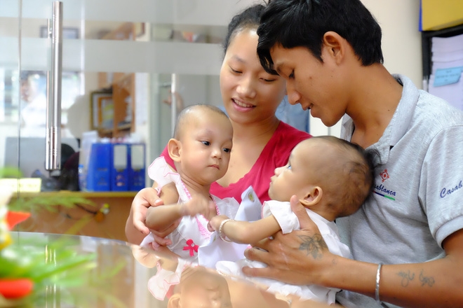 Ngắm vẻ đáng yêu của hai bé gái sinh đôi dính nhau vùng cùng cụt ngày xuất viện - Ảnh 4.