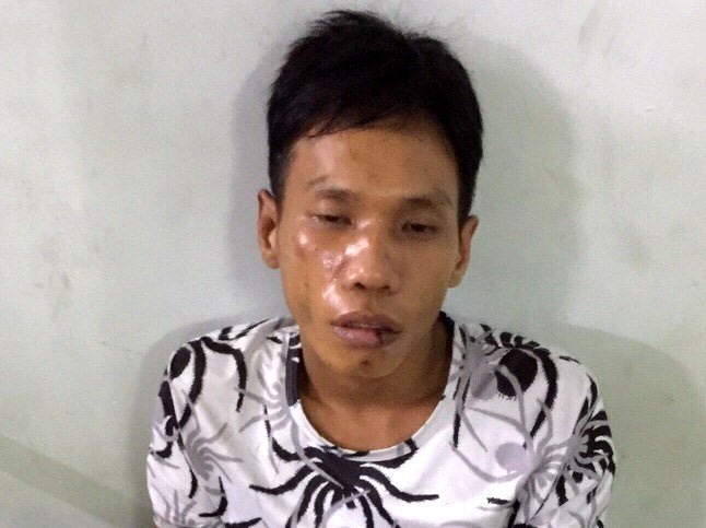 Nhau say lan quay ra via he ngu bi trom 'tho' xe may hinh anh 1