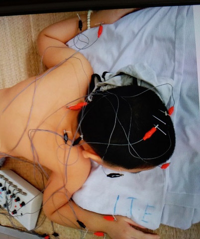 be trai 8 tuoi o ha noi mac benh la: cu ngoc dau len la ngat xiu - 4