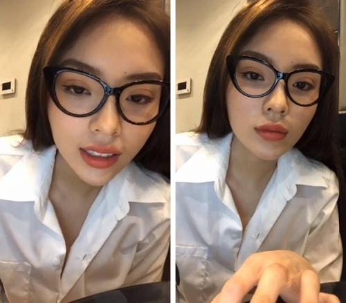 ky duyen tiep tuc dinh nghi ván phau thuat mi voi hinh anh doi mat khac la - 2