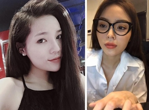 ky duyen tiep tuc dinh nghi ván phau thuat mi voi hinh anh doi mat khac la - 5