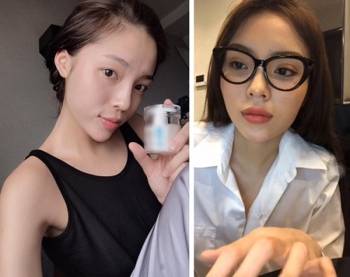 ky duyen tiep tuc dinh nghi ván phau thuat mi voi hinh anh doi mat khac la - 7