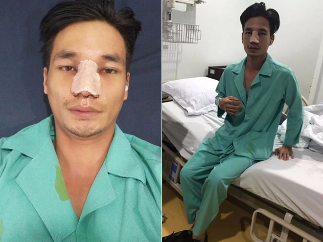 chan mui nhan tao, le roi lai sua de tim ve dien mao ban dau hinh anh 1