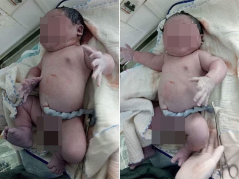 se trao chung nhan be so sinh nang can nhat viet nam cho be trai nang 7,1kg o vinh phuc hinh 1