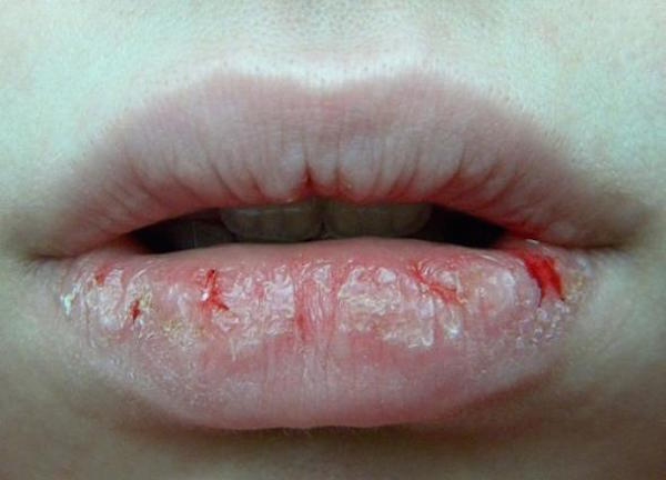 bo tui 3 cach duong moi kho nut tro nen mem min, cang muot khi troi chuyen mua hanh kho - 1