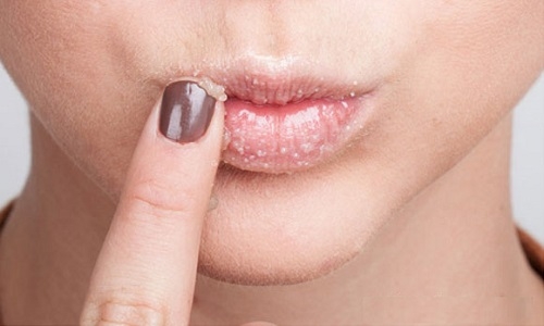 bo tui 3 cach duong moi kho nut tro nen mem min, cang muot khi troi chuyen mua hanh kho - 6