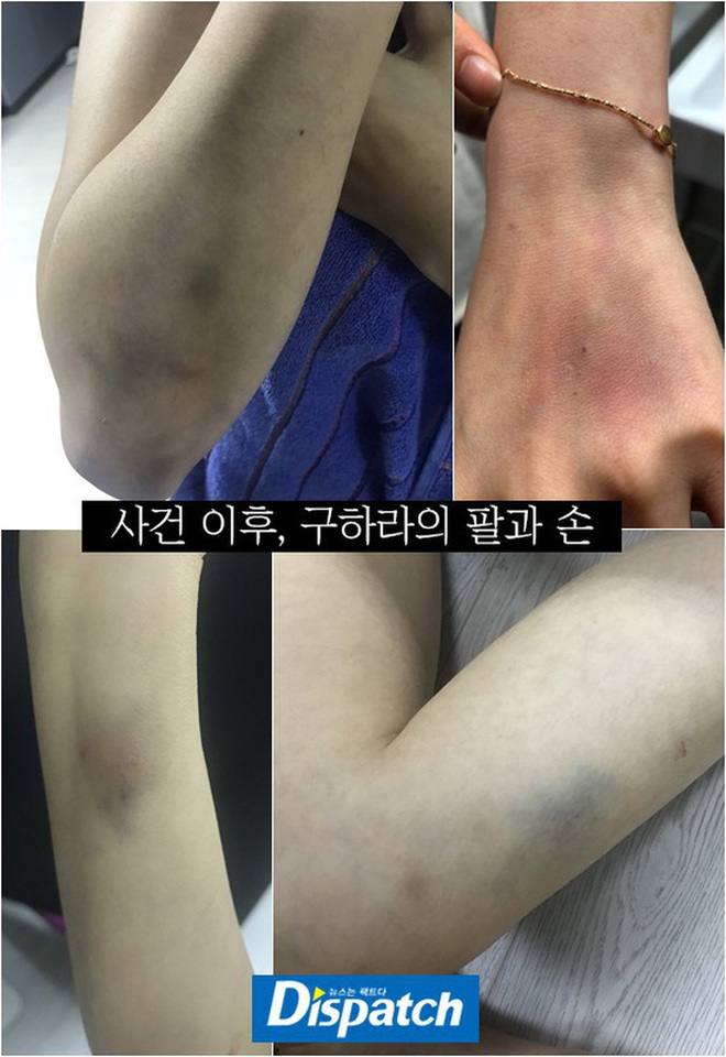 Mỹ nhân Hàn bị bạo hành: Choi Jin Sil - Goo Hara lâm vào bước đường tự tử, sao Hậu Duệ Mặt Trời bị chồng đánh và cấm gặp con 11 năm - 17 Mỹ nhân Hàn bị bạo hành: Choi Jin Sil - Goo Hara lâm vào bước đường tự tử, sao Hậu Duệ Mặt Trời bị chồng đánh và cấm gặp con 11 năm - 17